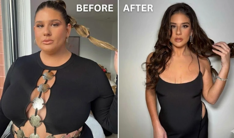 Remi Bader weight loss before and after